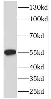 EML2 Rabbit Polyclonal Antibody