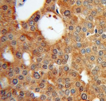 EML2 Rabbit Polyclonal Antibody