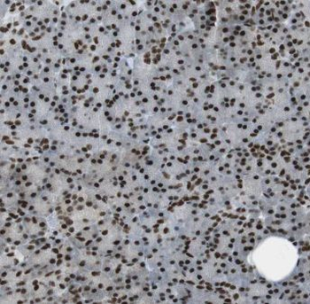 ENC1 Rabbit Polyclonal Antibody