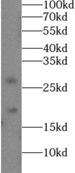COL18A1 Rabbit Polyclonal Antibody