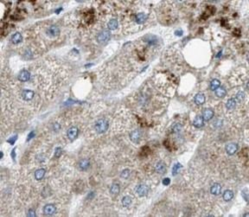 COL18A1 Rabbit Polyclonal Antibody