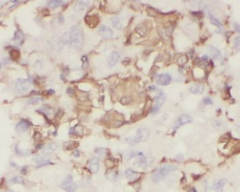 EDN1 Rabbit Polyclonal Antibody