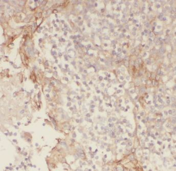 ENOX1 Rabbit Polyclonal Antibody