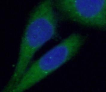 ENTPD1 Rabbit Polyclonal Antibody