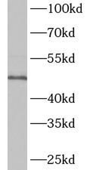 ENTPD1 Rabbit Polyclonal Antibody