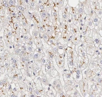 ENTPD1 Rabbit Polyclonal Antibody