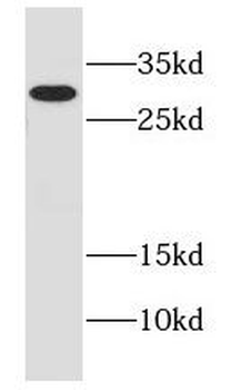 EFNA3 Rabbit Polyclonal Antibody