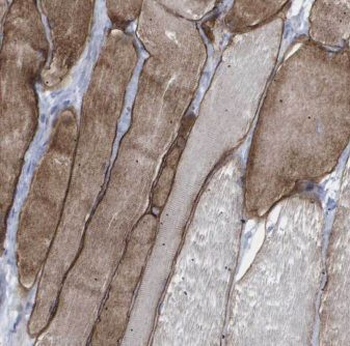 EFNA3 Rabbit Polyclonal Antibody