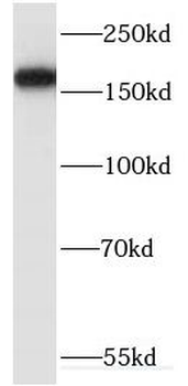 EPRS1 Rabbit Polyclonal Antibody