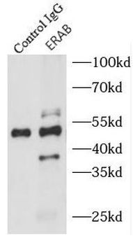 HSD17B10 Rabbit Polyclonal Antibody