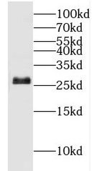 HSD17B10 Rabbit Polyclonal Antibody