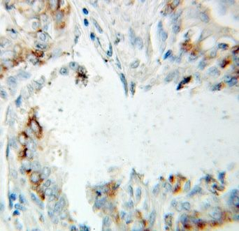 HSD17B10 Rabbit Polyclonal Antibody