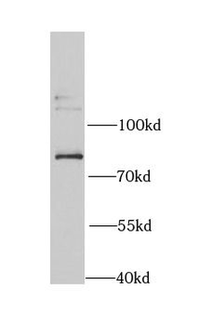 ERCC3 Rabbit Polyclonal Antibody