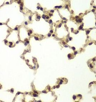 ERCC3 Rabbit Polyclonal Antibody