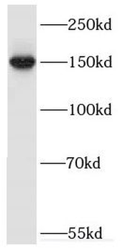 ERCC6 Rabbit Polyclonal Antibody