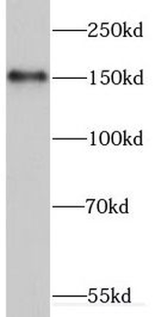 ERCC6 Rabbit Polyclonal Antibody