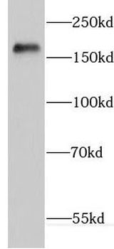 ERCC6L Rabbit Polyclonal Antibody