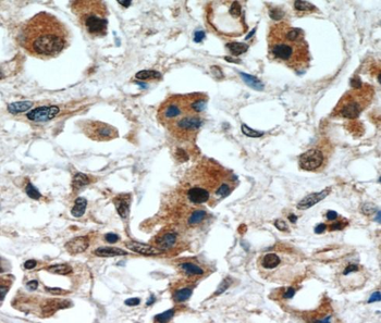 ERK1/2 Rabbit Polyclonal Antibody