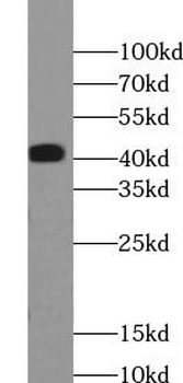 ERK1/2 Rabbit Polyclonal Antibody