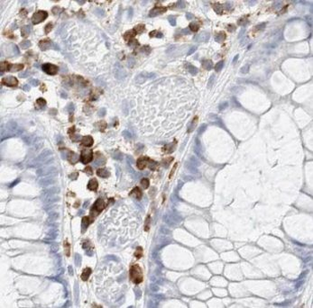 ERK1/2 Rabbit Polyclonal Antibody