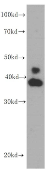 ERK1/2 Mouse Monoclonal Antibody