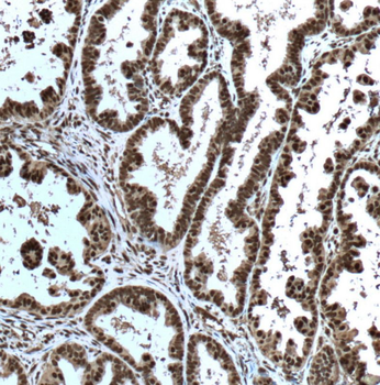 ERK1/2 Mouse Monoclonal Antibody