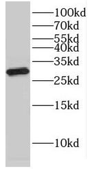 ERP29 Rabbit Polyclonal Antibody