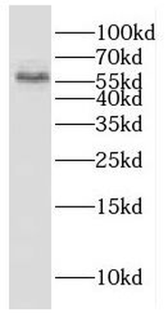 ESAM Rabbit Polyclonal Antibody