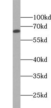 SELE Rabbit Polyclonal Antibody