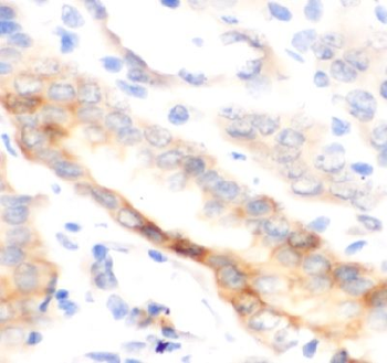 SELE Rabbit Polyclonal Antibody