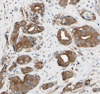 ETFDH Rabbit Polyclonal Antibody
