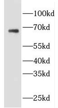 EVI2B Rabbit Polyclonal Antibody