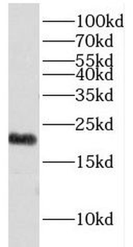 EXOSC1 Rabbit Polyclonal Antibody