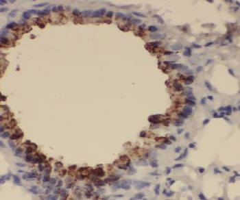 EXOSC1 Rabbit Polyclonal Antibody