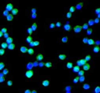 ADGRE1 Rabbit Polyclonal Antibody