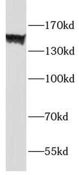 ADGRE1 Rabbit Polyclonal Antibody