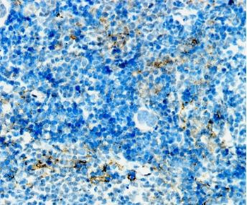 ADGRE1 Rabbit Polyclonal Antibody
