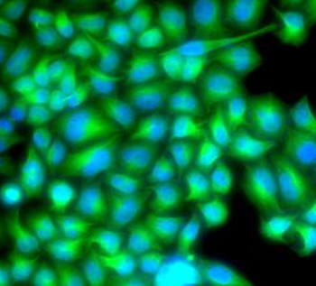 FABP3 Rabbit Polyclonal Antibody