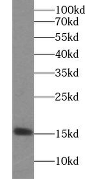 FABP3 Rabbit Polyclonal Antibody