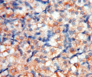 FABP3 Rabbit Polyclonal Antibody