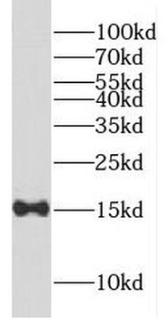 FABP4 Rabbit Polyclonal Antibody