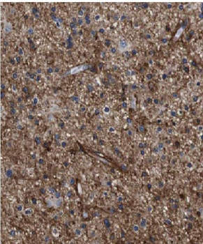 FABP7 Rabbit Polyclonal Antibody