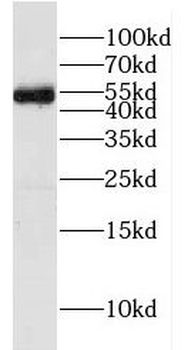FAF2 Rabbit Polyclonal Antibody