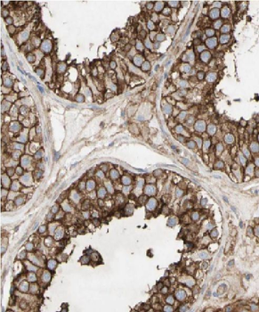 FAF2 Rabbit Polyclonal Antibody