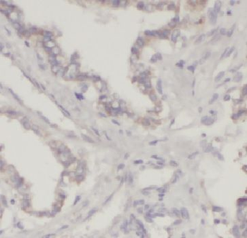 NIBAN1 Rabbit Polyclonal Antibody