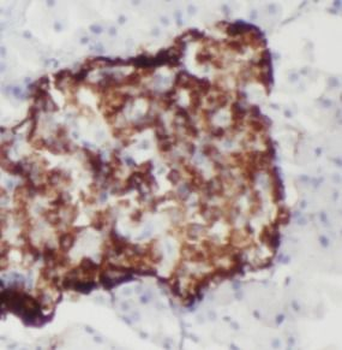 FAM3C Rabbit Polyclonal Antibody