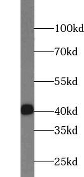 FAS Rabbit Polyclonal Antibody