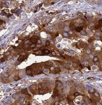 FAS Rabbit Polyclonal Antibody