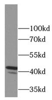 FAS Mouse Monoclonal Antibody