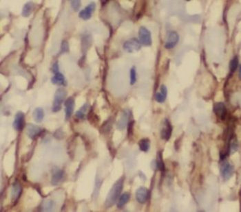 FAS Mouse Monoclonal Antibody